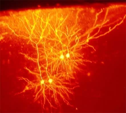 mouse cingulate cortex